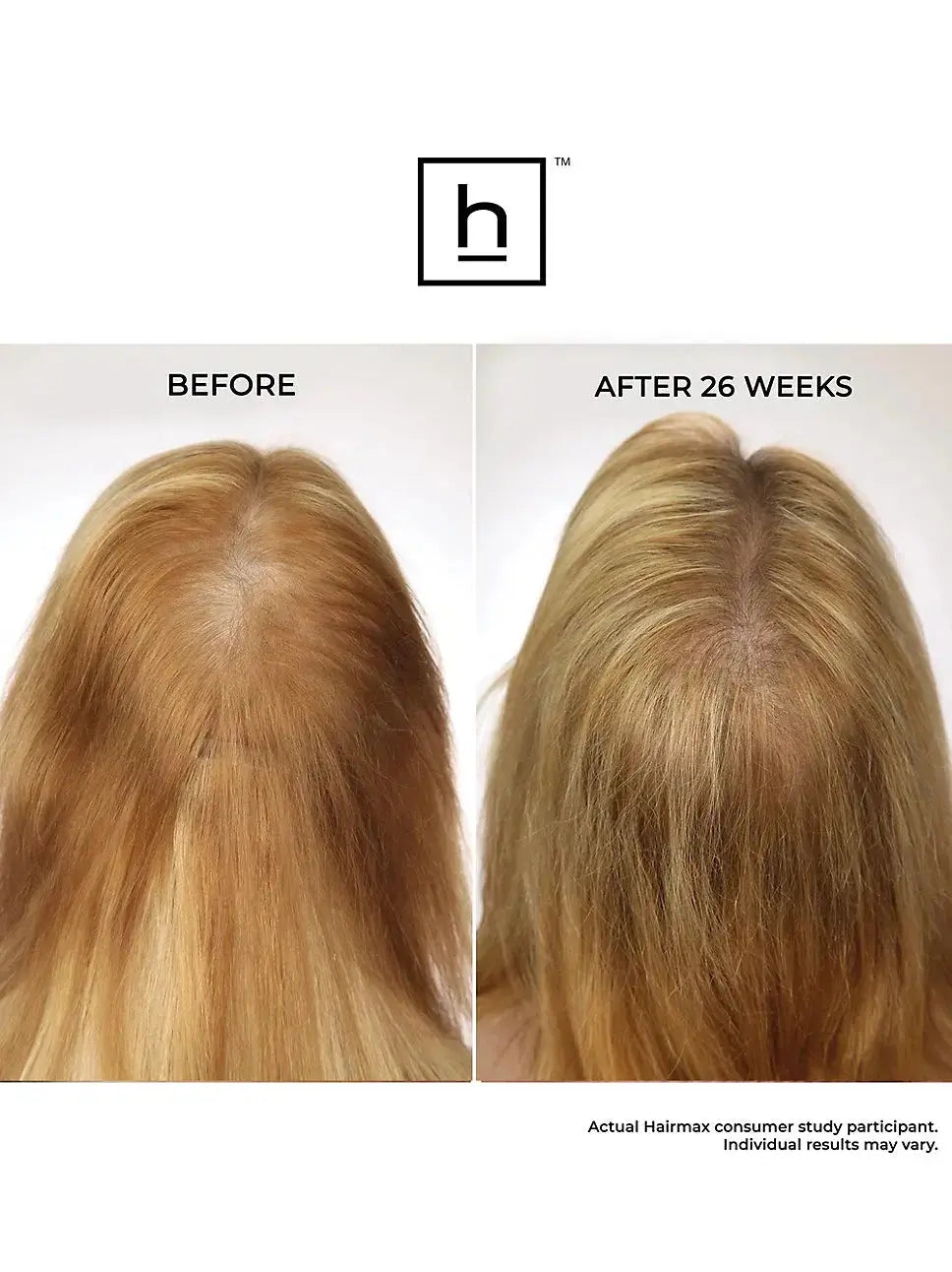 Bande laser Hairmax 82