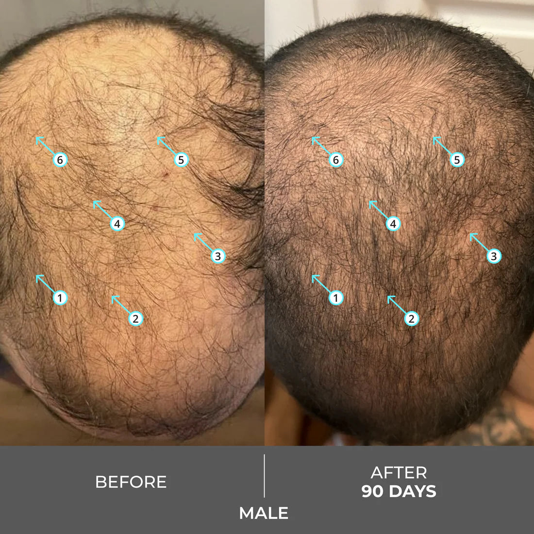 DS Laboratories -Extra Strength - Revita Shampoo tegen haaruitval