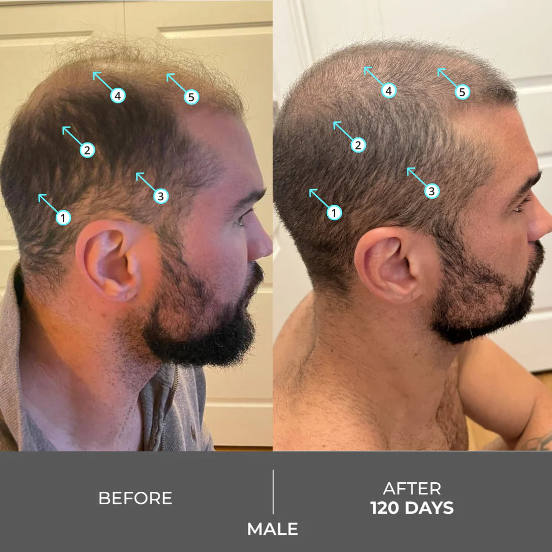 DS Laboratories -Extra Strength - Revita Shampoo tegen haaruitval