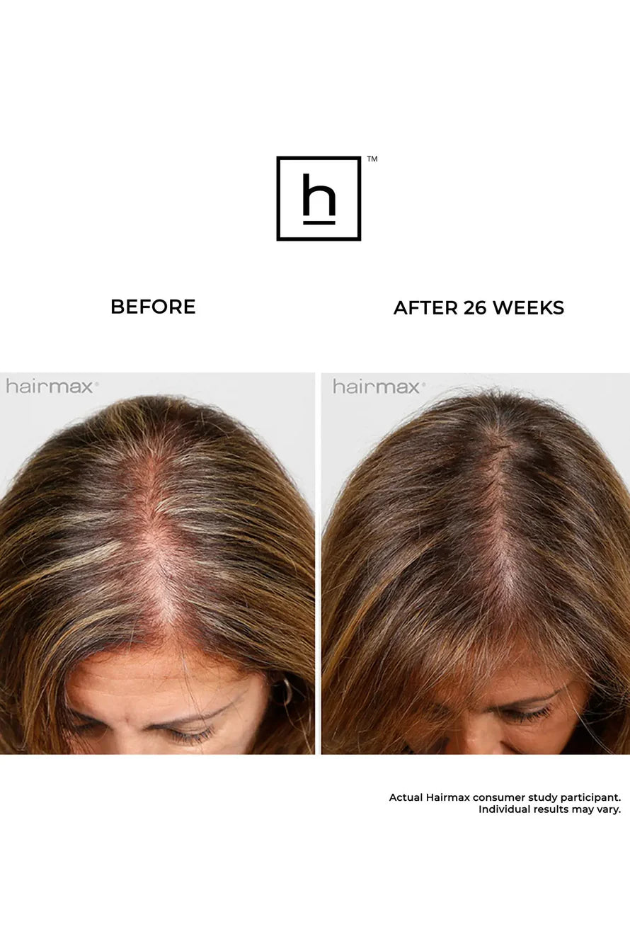 HairMax ULTIMA 9 LaserKam