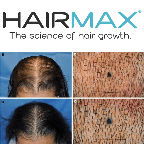 Hairmax LaserBand 41 Confort Flex