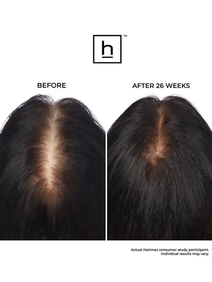 Bande laser Hairmax 82 