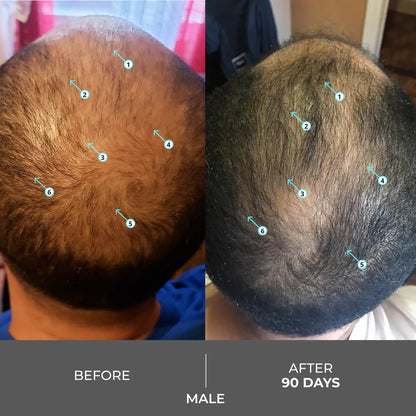 Shampooing Revita des Laboratoires DS contre la chute des cheveux