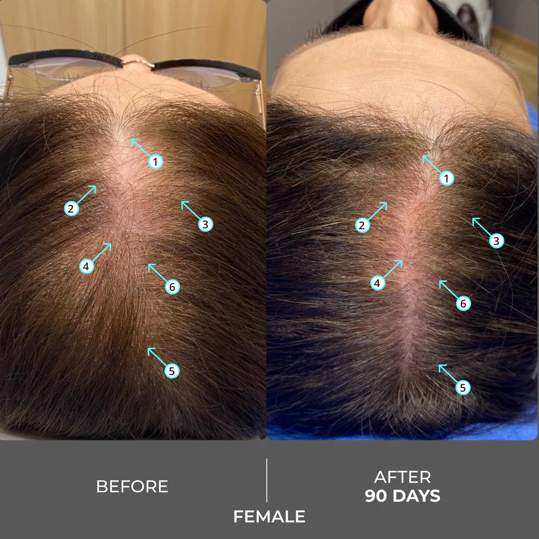 Shampooing Revita des Laboratoires DS contre la chute des cheveux