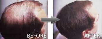 Mane Hair Thickening Spray - Lichtblond 200 ml