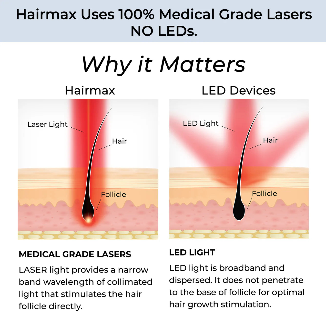Bande laser Hairmax 82 