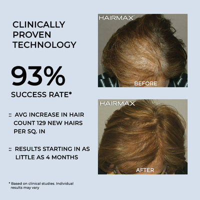 HairMax LaserBand 82 ComfortFlex
