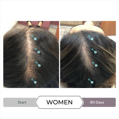 Women's Hair Loss Kit (Revita Shampoo/Conditioner + Spectral.CSF)